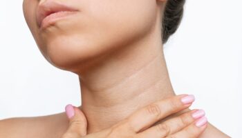 Кольца Венеры на&nbsp;шее: причины, что это такое и&nbsp;методы коррекции